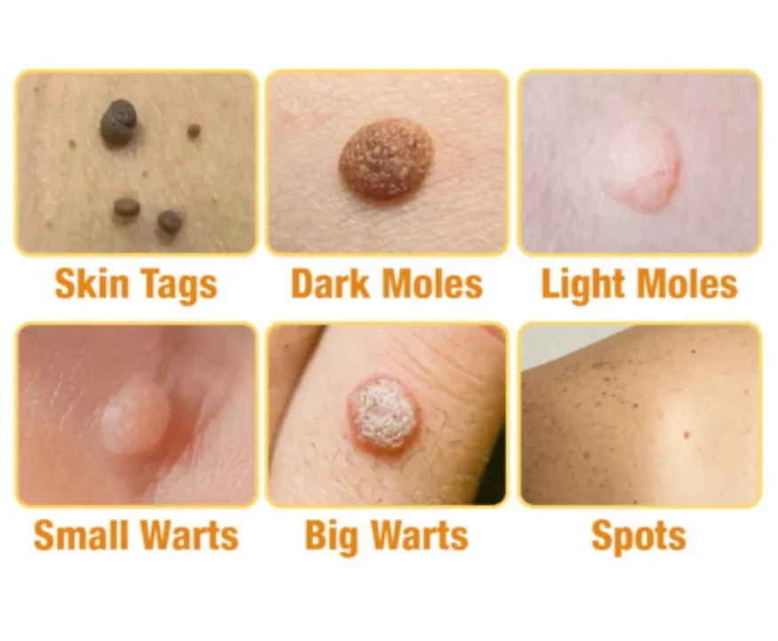 Immagine di pelle sana e liscia, simbolo del risultato finale